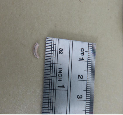 Photograph 7 - Debris From Diaphragm Metering Stem, from the NTSB investigation of Piper Aircraft INC PA-28-181 accident near Addison, Texas, January 15, 2025